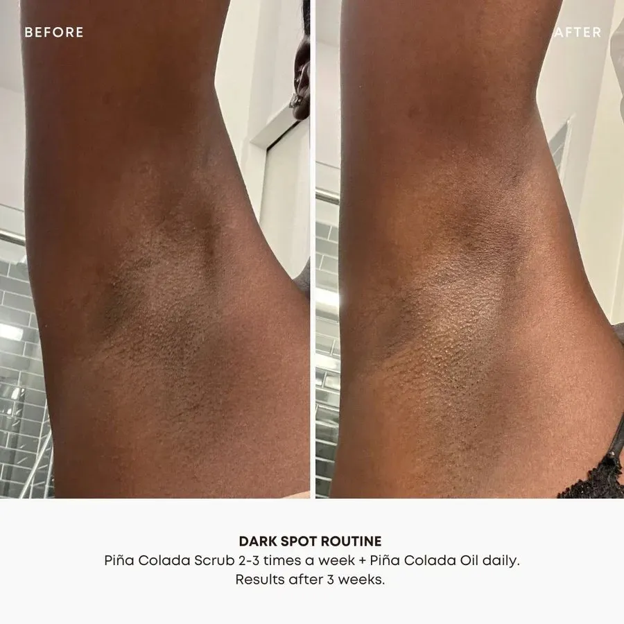 Dark Spot Exfoliating Scrub