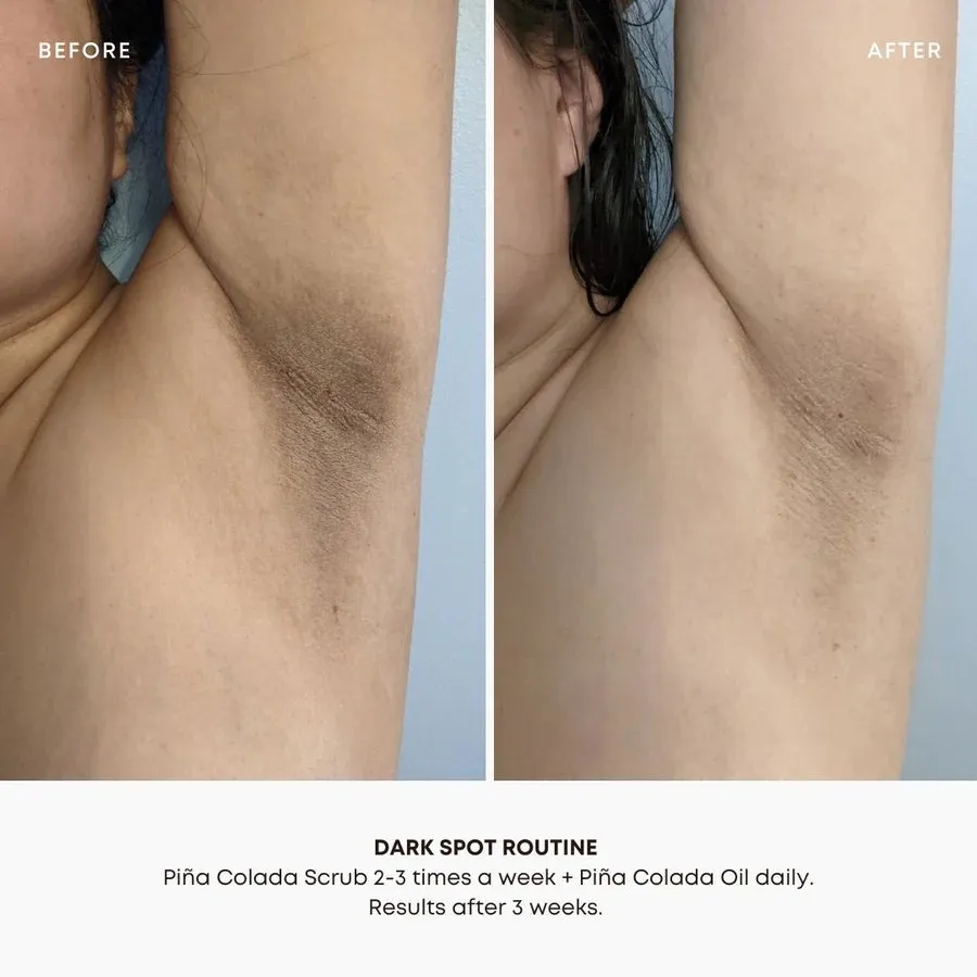 Dark Spot Exfoliating Scrub
